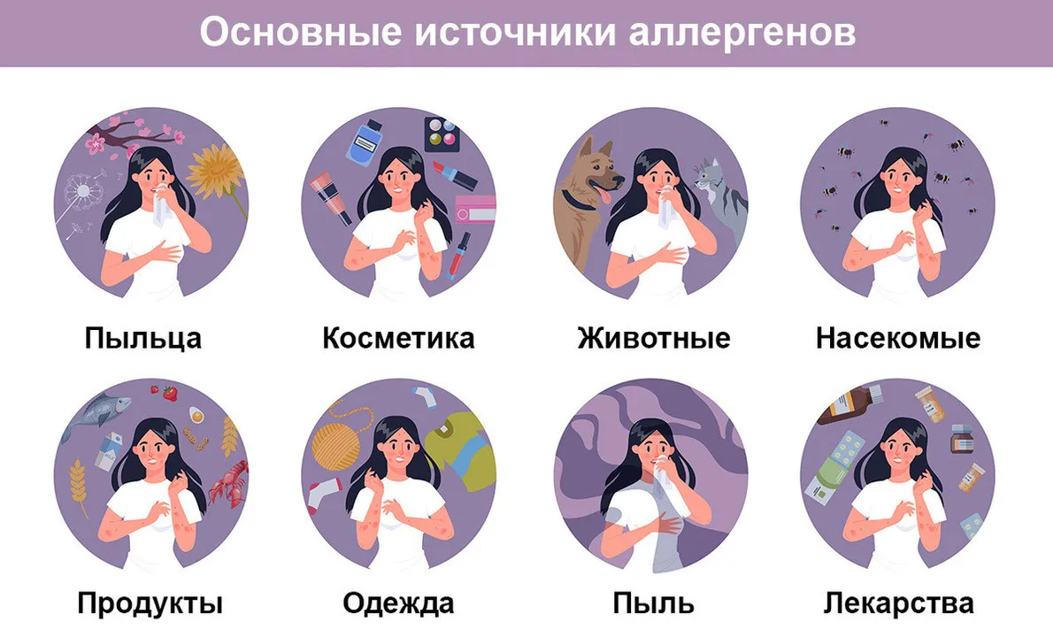 Отек Квинке - 51 фото