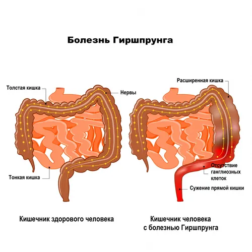 Пролежни Фото изображение