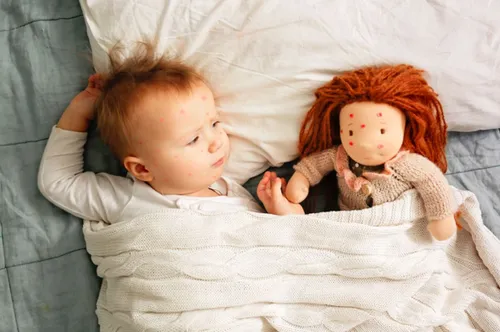 Скарлатина Фото ребенок спит рядом с мягкой игрушкой