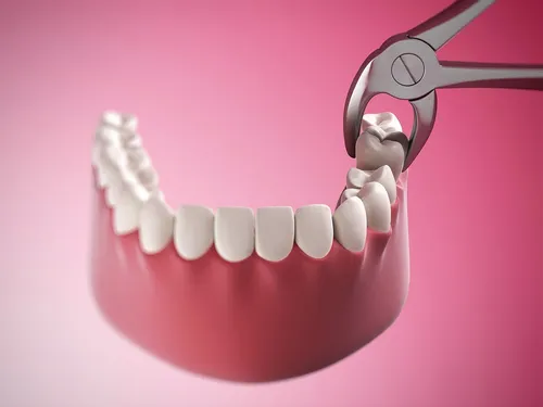 Этапы Заживления Лунки После Удаления Зуба Фото зубная щетка с зубной пастой