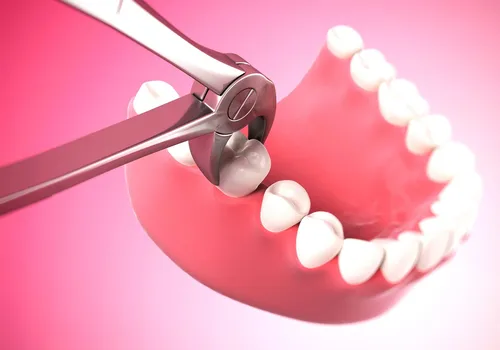 Этапы Заживления Лунки После Удаления Зуба Фото красная зубная щетка с зубной пастой
