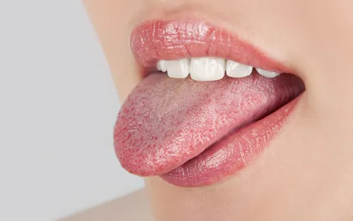 Болезни Языка Фото крупный план губ и зубов человека