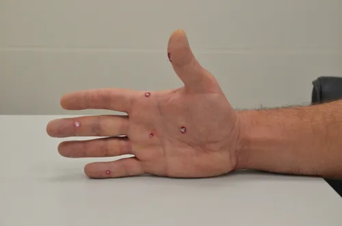 Бородавки Фото рука человека с нарисованным на ней ногтем