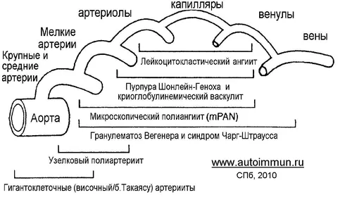 Васкулит Фото HD