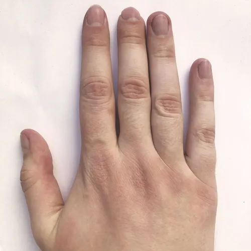 Васкулит Фото рука человека с нарисованными ногтями