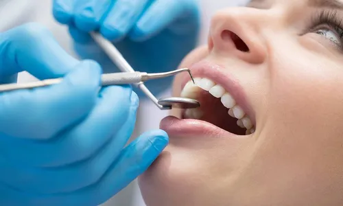 Кариес Фото стоматолог осматривает зубы пациента