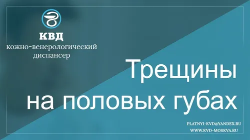 Кондиломы На Малых Губах Фото графический пользовательский интерфейс