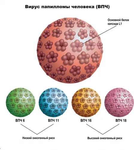 Кондиломы Фото диаграмма, пузырьковая диаграмма
