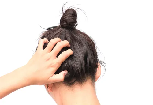 Нейродермит Фото женщина с волосами в пучке