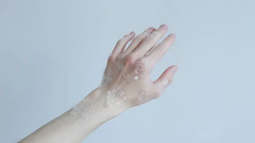 Нервная Экзема Фото рука, держащая белое вещество