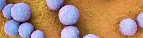 Стрептодермия Фото группа фиолетовых шаров