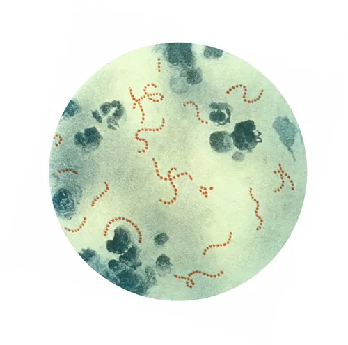 Стрептодермия Фото бело-красная скала