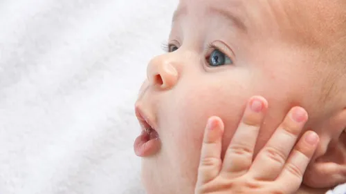 Аллергическая Сыпь У Ребенка Фото ребенок с открытым ртом