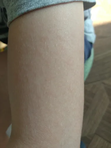 Аллергия На Солнце Фото крупный план руки человека