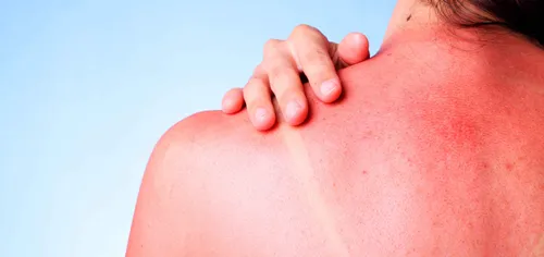 Аллергия На Солнце Фото крупный план живота человека