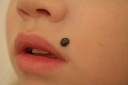 Безвредные Папилломы Фото крупный план губ человека и маленький черный предмет