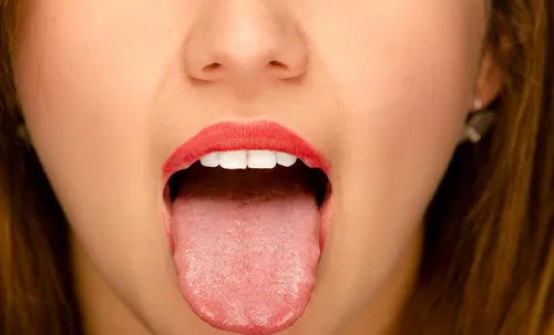 Воспаление Языка Фото женщина с открытым ртом