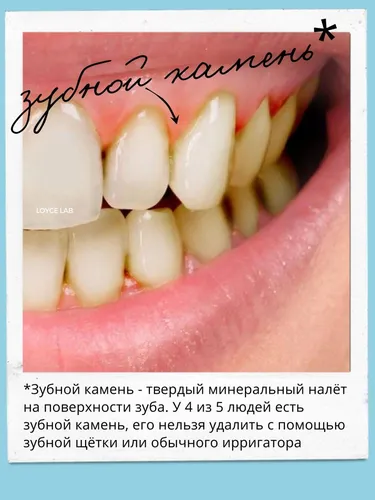 Зубной Камень Фото для Windows